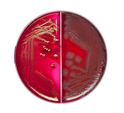 Thermo Scientific Columbia-Agar mit Blut/Endo-Agar Columbia-Agar mit Blut/Endo-Agar | Buy Online | Thermo Scientific&trade; | Fisher Scientific